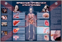 Электрифицированный стенд "Вредные привычки: алкоголизм" - «globural.ru» - Краснодар