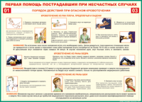 Таблица Порядок действий при опасном кровотечении 1000*1400 винил - «globural.ru» - Краснодар